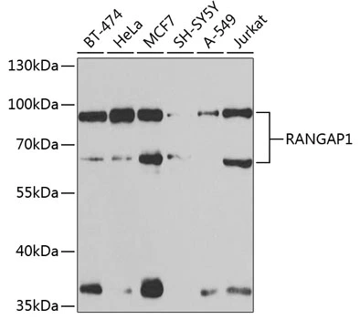 WB analysis of various sample lysates using GTX65813 RanGAP1 antibody. Dilution : 1:1000 Loading : 25microg per lane WB analysis of various sample lysates using GTX65813 RanGAP1 antibody. Dilution : 1:1000 Loading : 25microg per lane