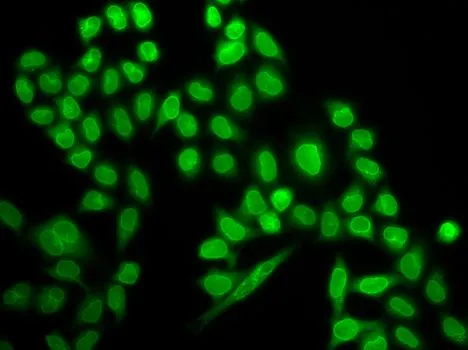 ICC/IF analysis of MCF7 cells using GTX65813 RanGAP1 antibody.