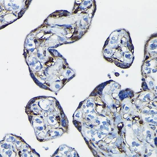 IHC-P analysis of human placenta tissue using GTX65813 RanGAP1 antibody. Dilution : 1:50