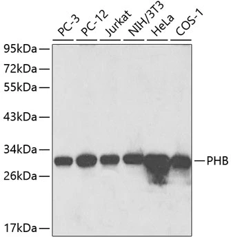 WB analysis of various sample lysates using GTX65815 Prohibitin antibody. Dilution : 1:1000 Loading : 25microg per lane