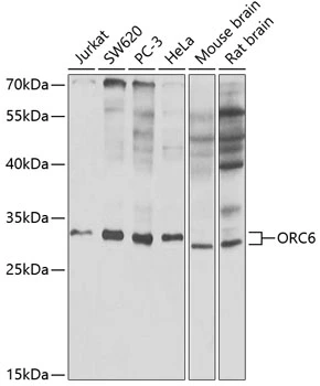 WB analysis of various sample lysates using GTX65816 ORC6 antibody. Dilution : 1:1000 Loading : 25microg per lane WB analysis of various sample lysates using GTX65816 ORC6 antibody. Dilution : 1:1000 Loading : 25microg per lane