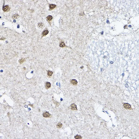 IHC-P analysis of human brain tissue using GTX65816 ORC6 antibody. Dilution : 1:200