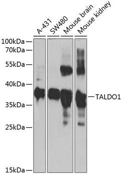 WB analysis of various sample lysates using GTX65820 Transaldolase antibody. Dilution : 1:1000 Loading : 25microg per lane WB analysis of various sample lysates using GTX65820 Transaldolase antibody. Dilution : 1:1000 Loading : 25microg per lane