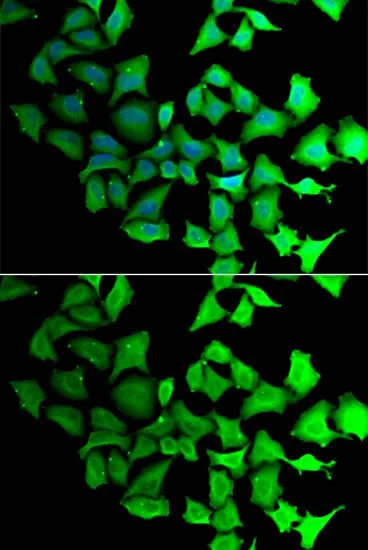 ICC/IF analysis of HeLa cells using GTX65820 Transaldolase antibody. Blue : DAPI