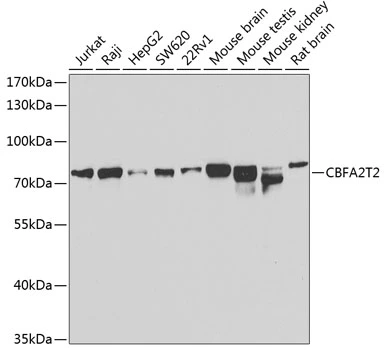 WB analysis of various sample lysates using GTX65822 MTGR1 antibody. Dilution : 1:1000 Loading : 25microg per lane WB analysis of various sample lysates using GTX65822 MTGR1 antibody. Dilution : 1:1000 Loading : 25microg per lane