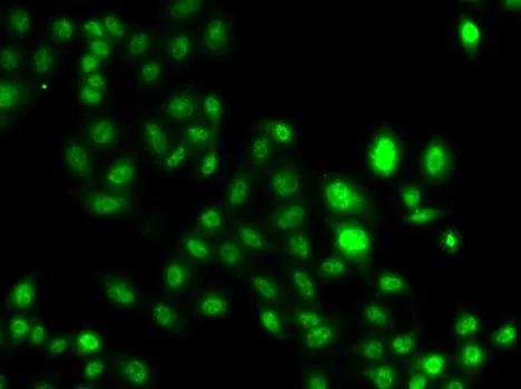 ICC/IF analysis of U2OS cells using GTX65822 MTGR1 antibody.