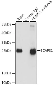 IP analysis of HeLa cell lysate using GTX65823 BCAP31 antibody. Antibody amount : 3microg / 200microg lysate Dilution : 1:1000 IP analysis of HeLa cell lysate using GTX65823 BCAP31 antibody. Antibody amount : 3microg / 200microg lysate Dilution : 1:1000
