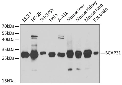 WB analysis of various sample lysates using GTX65823 BCAP31 antibody. Dilution : 1:1000 Loading : 25microg per lane