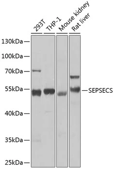 WB analysis of various sample lysates using GTX65825 SLA/LP antibody. Dilution : 1:1000 Loading : 25microg per lane WB analysis of various sample lysates using GTX65825 SLA/LP antibody. Dilution : 1:1000 Loading : 25microg per lane