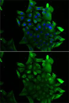 ICC/IF analysis of U2OS cells using GTX65825 SLA/LP antibody. Blue : DAPI