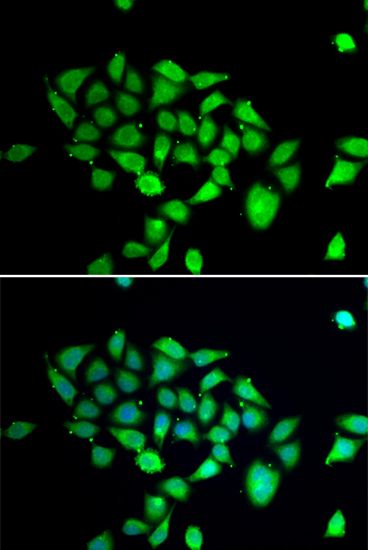 ICC/IF analysis of A549 cells using GTX65827 DPRP1 antibody. Blue : DAPI