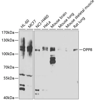 WB analysis of various sample lysates using GTX65827 DPRP1 antibody. Dilution : 1:1000 Loading : 25microg per lane WB analysis of various sample lysates using GTX65827 DPRP1 antibody. Dilution : 1:1000 Loading : 25microg per lane