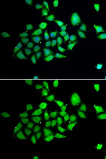 ICC/IF analysis of A549 cells using GTX65827 DPRP1 antibody. Blue : DAPI
