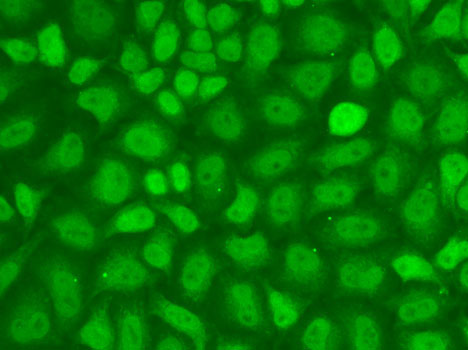 ICC/IF analysis of HeLa cells using GTX65832 CGBP antibody. Blue : DAPI