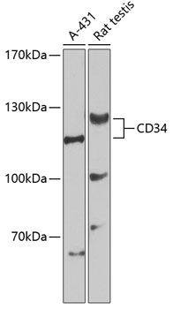 ICC/IF analysis of HUVEC cells using GTX65833 CD34 antibody. Blue : DAPI