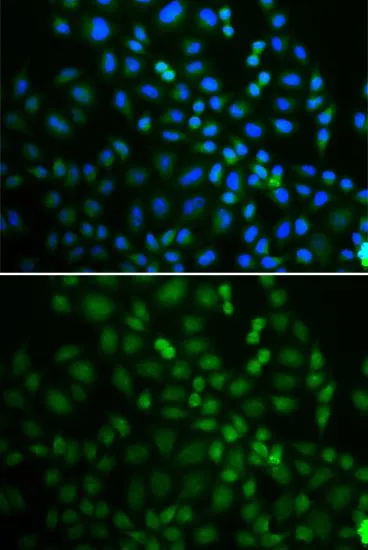 ICC/IF analysis of U2OS cells using GTX65834 SSA1 antibody. Blue : DAPI
