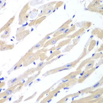IHC-P analysis of mouse heart tissue using GTX65834 SSA1 antibody. Dilution : 1:100