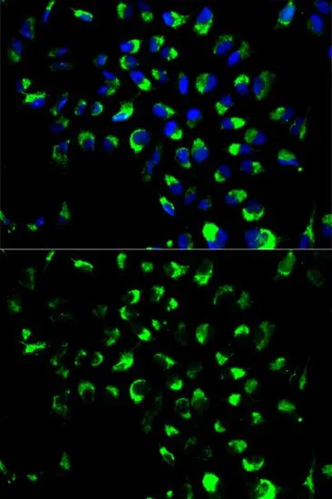 ICC/IF analysis of A549 cells using GTX65835 Adenylate Kinase 4 antibody. Blue : DAPI