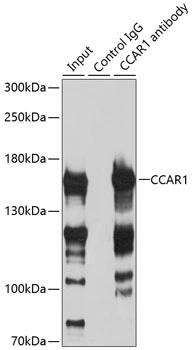 IP analysis of HeLa cell lysate using GTX65837 CCAR1 antibody. Antibody amount : 3microg / 200microg lysate Dilution : 1:500 IP analysis of HeLa cell lysate using GTX65837 CCAR1 antibody. Antibody amount : 3microg / 200microg lysate Dilution : 1:500