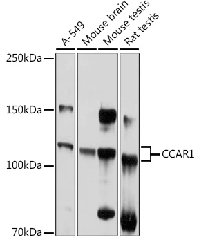 WB analysis of various sample lysates using GTX65837 CCAR1 antibody. Dilution : 1:1000 Loading : 25microg per lane