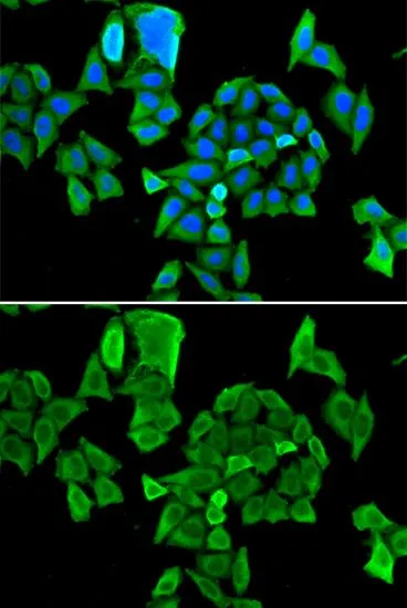 ICC/IF analysis of HeLa cells using GTX65837 CCAR1 antibody. Blue : DAPI