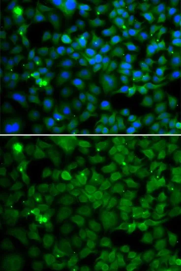 ICC/IF analysis of MCF7 cells using GTX65838 SMYD4 antibody. Blue : DAPI