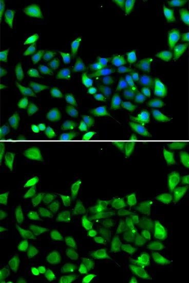 ICC/IF analysis of U2OS cells using GTX65839 eIF3H / EIF3S3 antibody. Blue : DAPI
