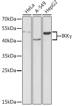 WB analysis of various sample lysates using GTX65841 IKK gamma antibody. Dilution : 1:1000 Loading : 25microg per lane WB analysis of various sample lysates using GTX65841 IKK gamma antibody. Dilution : 1:1000 Loading : 25microg per lane