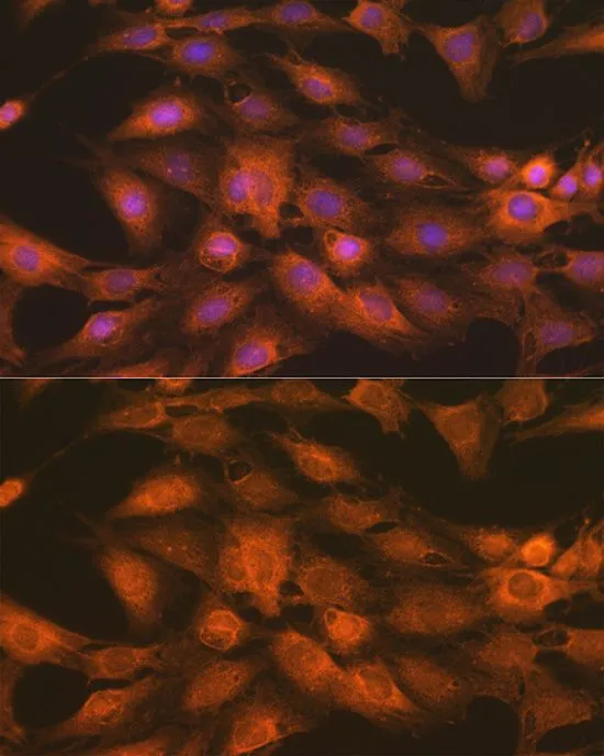 ICC/IF analysis of C6 cells using GTX65841 IKK gamma antibody. Blue : DAPI Dilution : 1:100