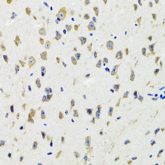 IHC-P analysis of mouse brain tissue using GTX65841 IKK gamma antibody. Dilution : 1:100