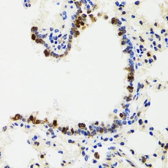 IHC-P analysis of rat lung tissue using GTX65841 IKK gamma antibody. Dilution : 1:100