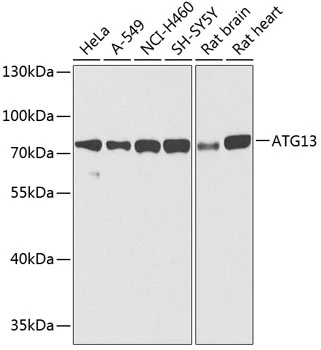 WB analysis of various sample lysates using GTX65842 ATG13 antibody. The signal was developed with ECL plus-Enhanced. Dilution : 1:1000 Loading : 25microg per lane WB analysis of various sample lysates using GTX65842 ATG13 antibody. The signal was developed with ECL plus-Enhanced. Dilution : 1:1000 Loading : 25microg per lane