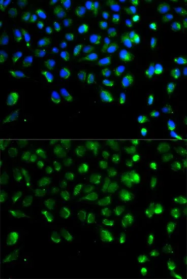 ICC/IF analysis of A549 cells using GTX65842 ATG13 antibody. Blue : DAPI