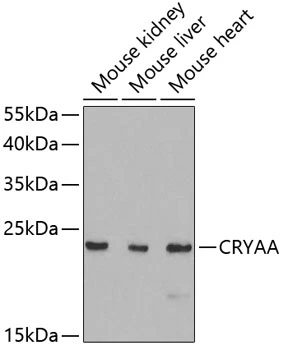 WB analysis of various sample lysates using GTX65843 alpha A Crystallin antibody. Dilution : 1:1000 Loading : 25microg per lane WB analysis of various sample lysates using GTX65843 alpha A Crystallin antibody. Dilution : 1:1000 Loading : 25microg per lane