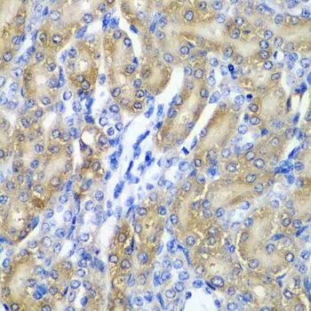 IHC-P analysis of rat kidney tissue using GTX65843 alpha A Crystallin antibody. Dilution : 1:200