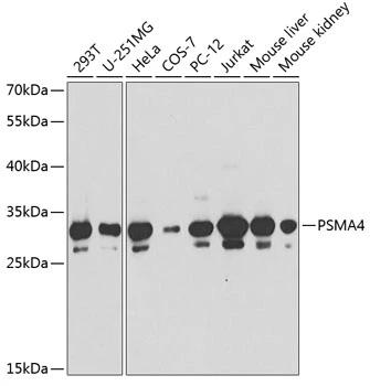 WB analysis of various sample lysates using GTX65846 PSMA4 antibody. Dilution : 1:1000 Loading : 25microg per lane WB analysis of various sample lysates using GTX65846 PSMA4 antibody. Dilution : 1:1000 Loading : 25microg per lane