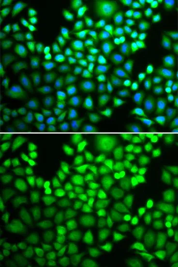 ICC/IF analysis of U2OS cells using GTX65846 PSMA4 antibody. Blue : DAPI