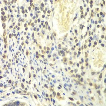 IHC-P analysis of human colon tissue using GTX65846 PSMA4 antibody. Dilution : 1:100