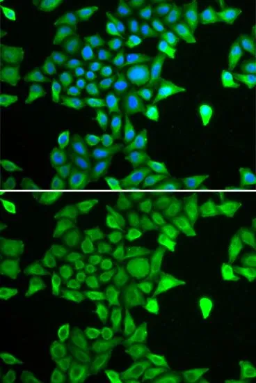 ICC/IF analysis of MCF7 cells using GTX65847 PSMA6 antibody. Blue : DAPI