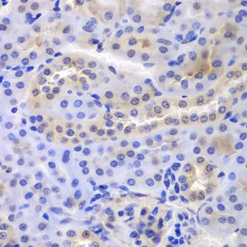 IHC-P analysis of mouse kidney tissue using GTX65847 PSMA6 antibody. Dilution : 1:100
