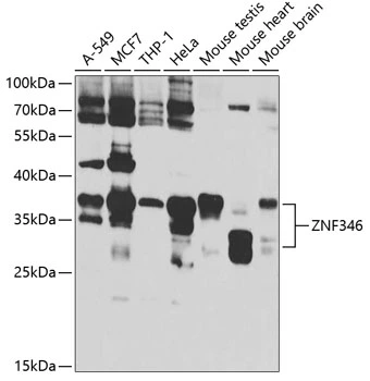 WB analysis of various sample lysates using GTX65857 ZNF346 antibody. Dilution : 1:1000 Loading : 25microg per lane WB analysis of various sample lysates using GTX65857 ZNF346 antibody. Dilution : 1:1000 Loading : 25microg per lane