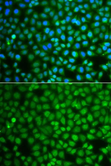 ICC/IF analysis of A549 cells using GTX65857 ZNF346 antibody. Blue : DAPI