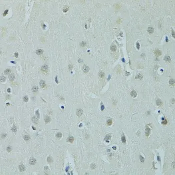 IHC-P analysis of rat brain tissue using GTX65857 ZNF346 antibody. Dilution : 1:100