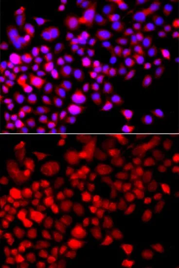 ICC/IF analysis of A549 cells using GTX65858 CoCoA antibody. Blue : DAPI