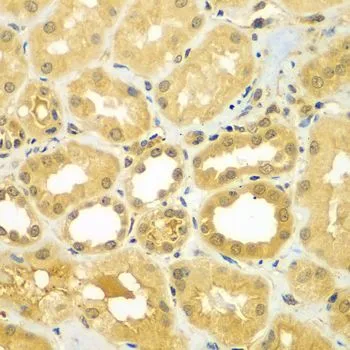 IHC-P analysis of human kidney tissue using GTX65858 CoCoA antibody. Dilution : 1:100