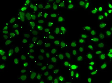 ICC/IF analysis of A549 cells using GTX65860 PC4 antibody.