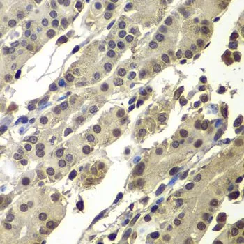 IHC-P analysis of human stomach tissue using GTX65860 PC4 antibody. Dilution : 1:100