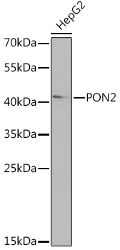 WB analysis of HepG2 cell lysate using GTX65861 PON2 antibody. Dilution : 1:1000 Loading : 25microg per lane WB analysis of HepG2 cell lysate using GTX65861 PON2 antibody. Dilution : 1:1000 Loading : 25microg per lane