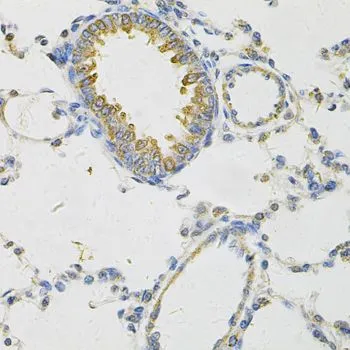 IHC-P analysis of rat lung tissue using GTX65861 PON2 antibody. Dilution : 1:100