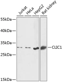 WB analysis of various sample lysates using GTX65866 CLIC1 antibody. Dilution : 1:1000 Loading : 25microg per lane